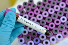 ZNP i samorządowcy apelują o szybkie i bezpłatne testy na koronawirusa dla nauczycieli i pracowników oświaty...