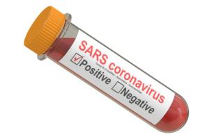 Rozporządzenie ministra blokadą dla komercyjnych testów na koronawirusa