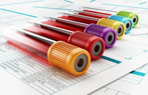 Student-krwiodawca może mieć kłopoty