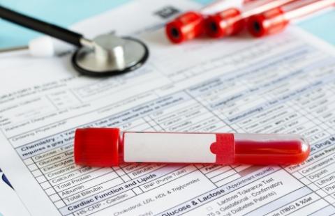 W przyszłym roku opłaty za składniki krwi wzrosną