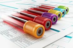 Badania krwi i test na HIV warunkiem otrzymania kredytu?